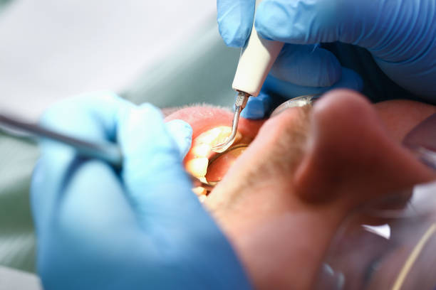Best Emergency TMJ Treatment in Baldwin, LA